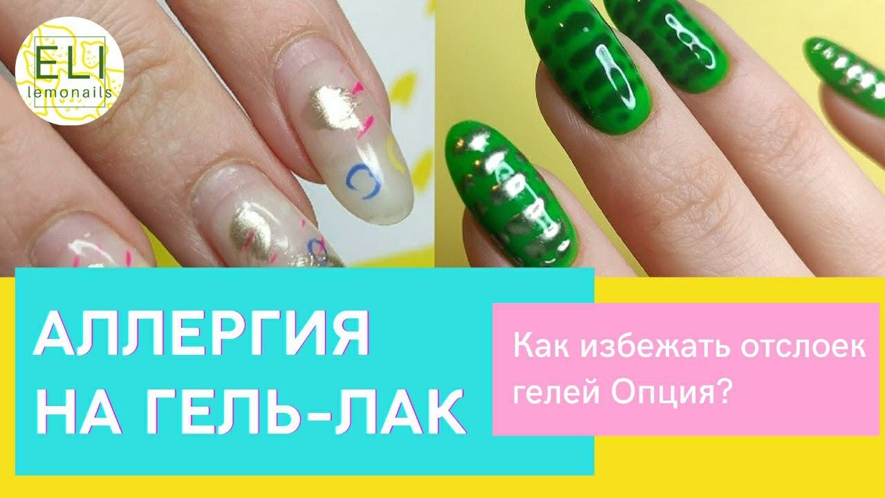 АЛЛЕРГИЯ на гель лак, что делать?! /