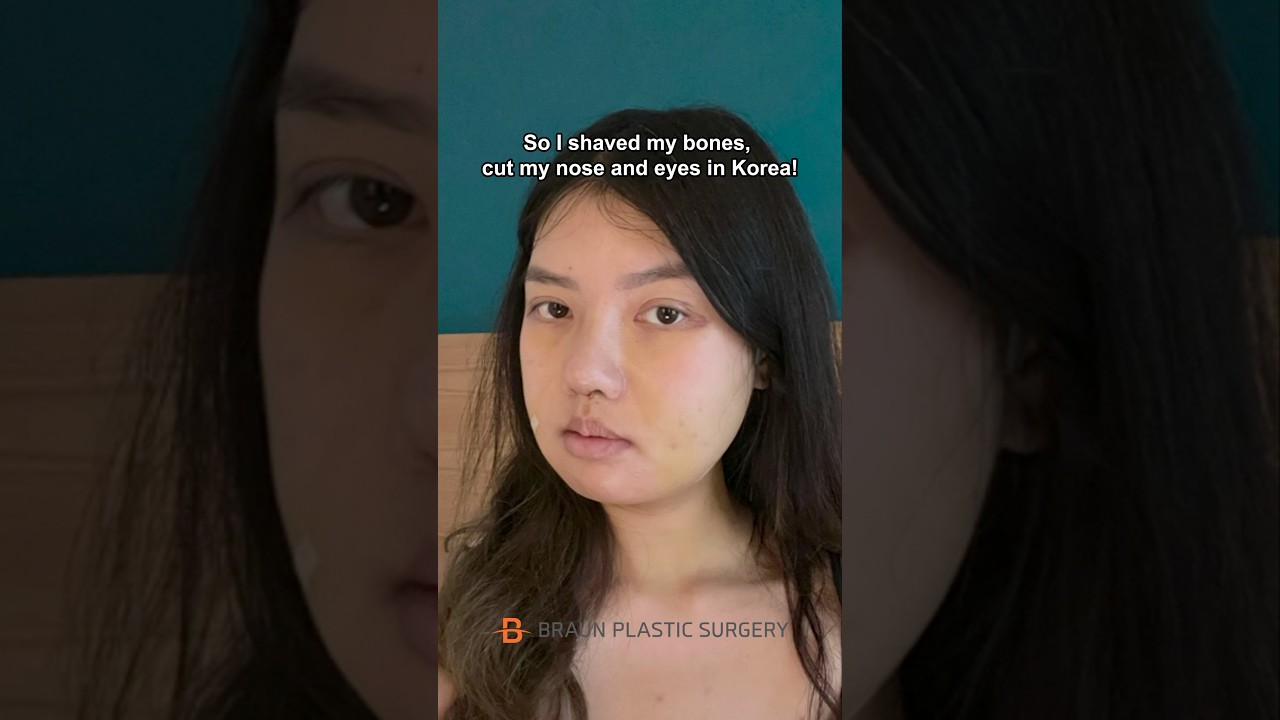 I BORN AGAIN AS BLACKPINK LISA?!😱😱😱 #fyp #glowup #blackpink #skincare #rhinoplasty #lisa