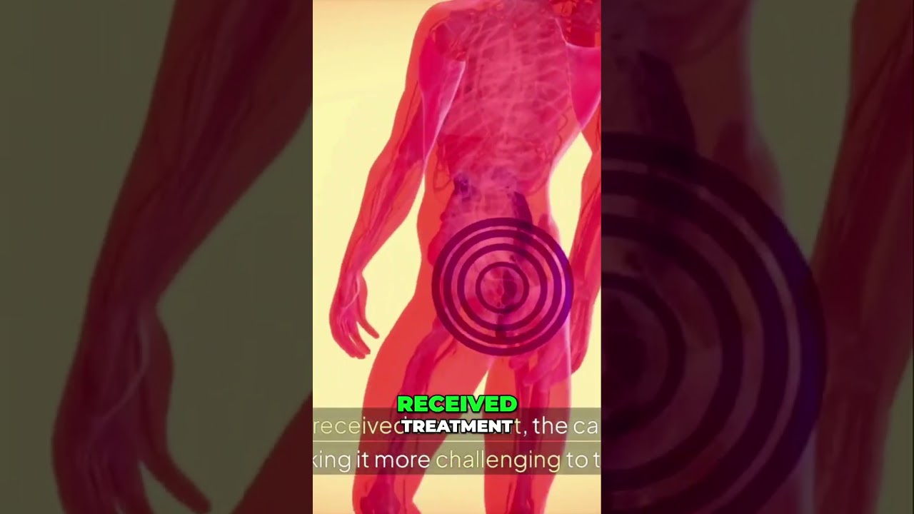 7 Early Colon Cancer Warning Signs You Must Know!