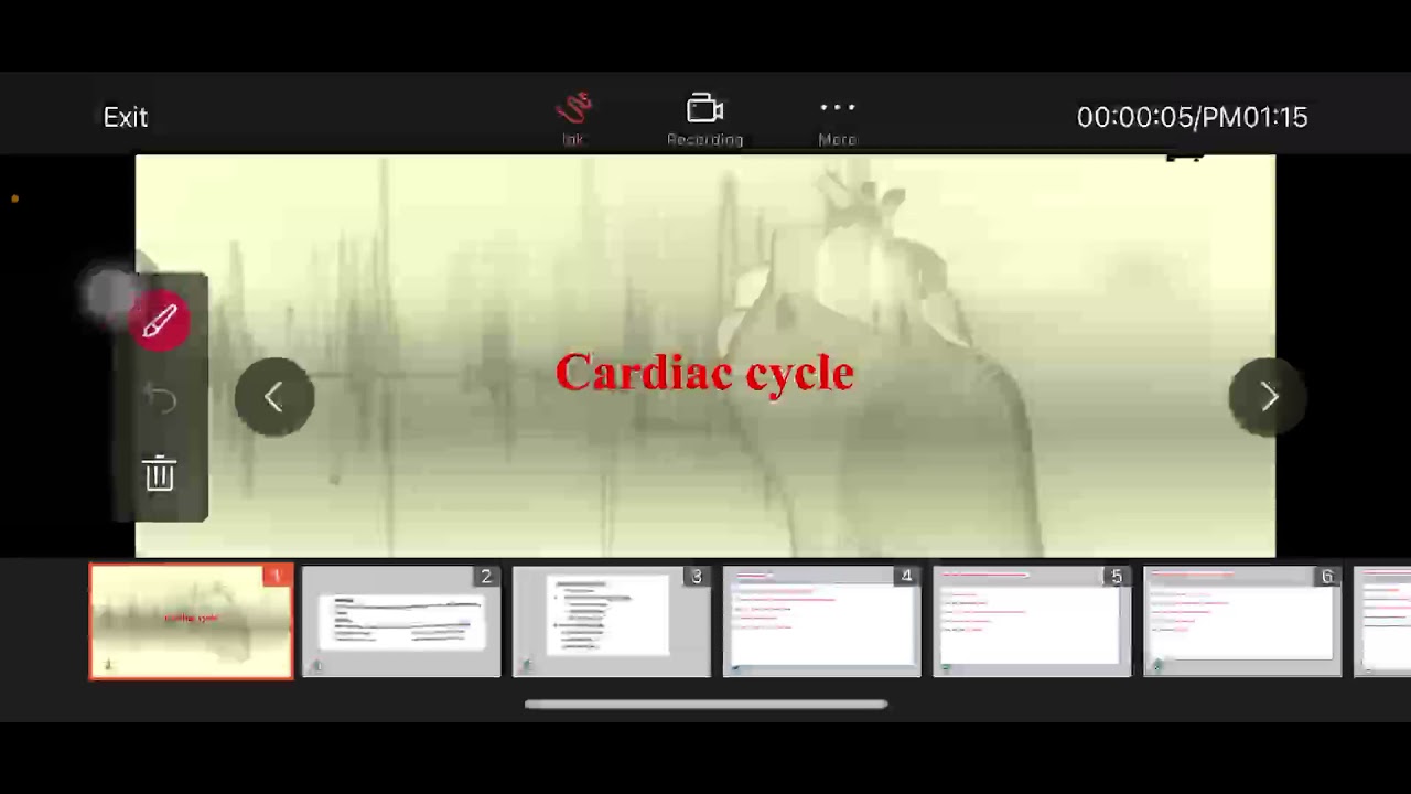 cardiac cycle, Physiology, L6