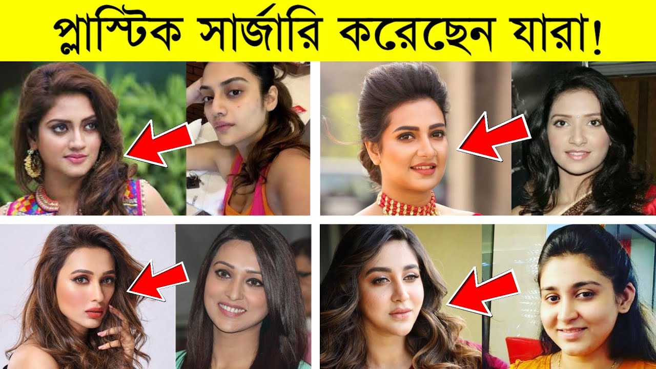কলকাতার যেসব নায়িকারা প্লাস্টিক সার্জারি করে সুন্দরী হয়েছে | Kolkata Actress Plastic surgery