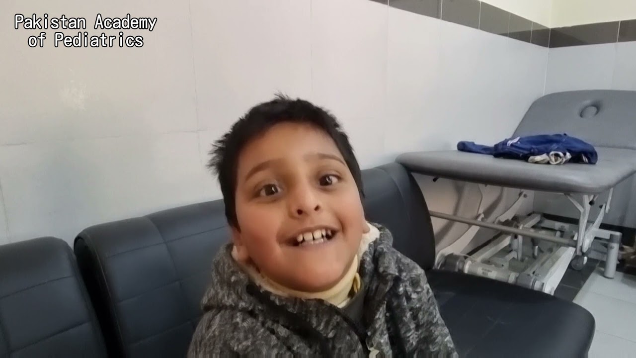 Spastic Diplegia (Teaching on Patient)