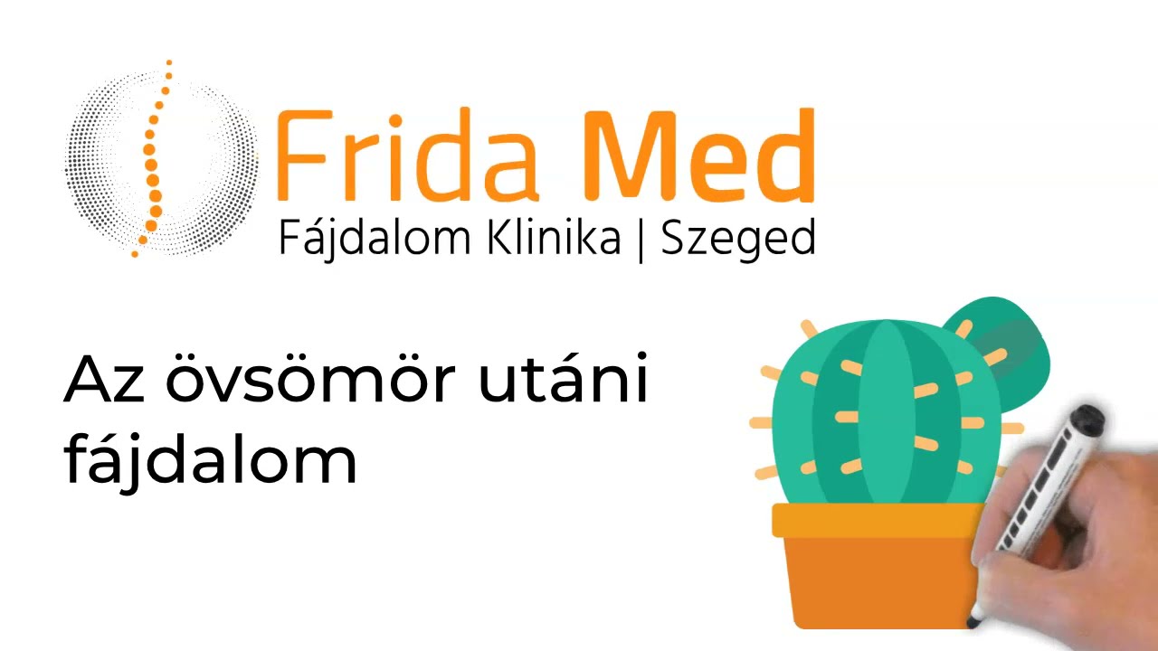 Az övsömör utáni fájdalom (posztherpeszes neuralgia)