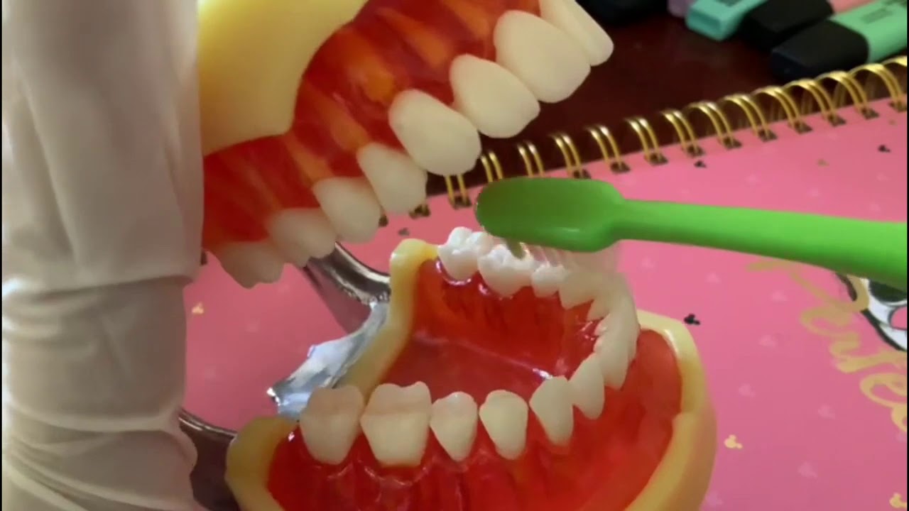 Técnicas de cepillado para niños con síndrome de down