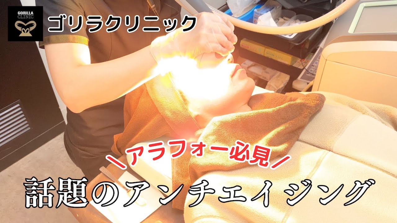 アラフォー必見のアンチエイジング！ゴリラクリニックのシミ取り治療プレミアムをしてきました【ライムライト、アキュティップ】