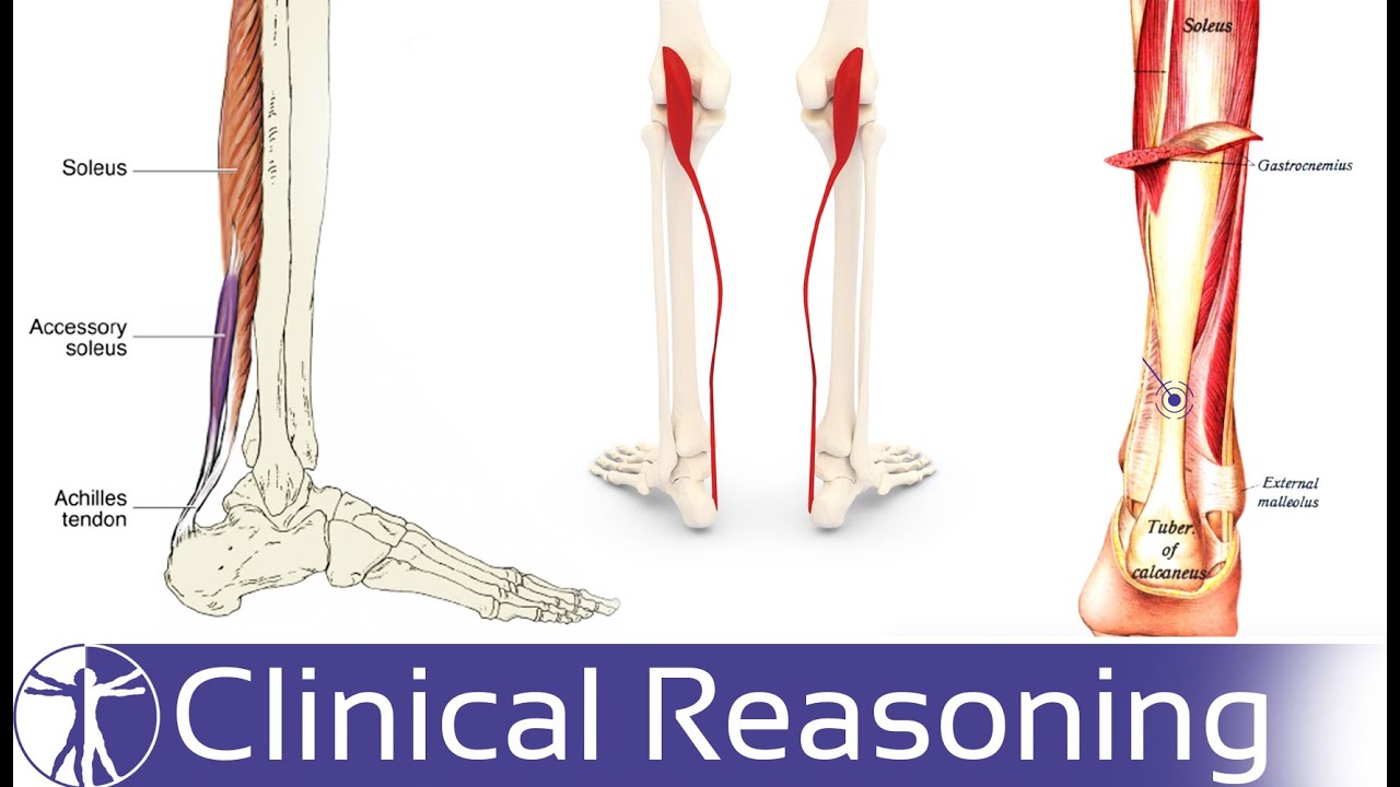 Achilles Tendinopathy Differential Diagnosis