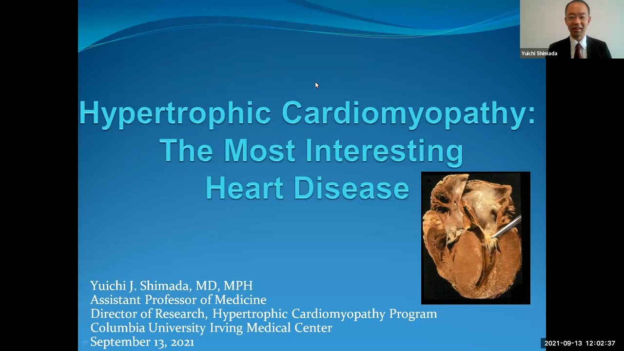 Hypertrophic Cardiomyopathy: The Most Interesting Heart Disease