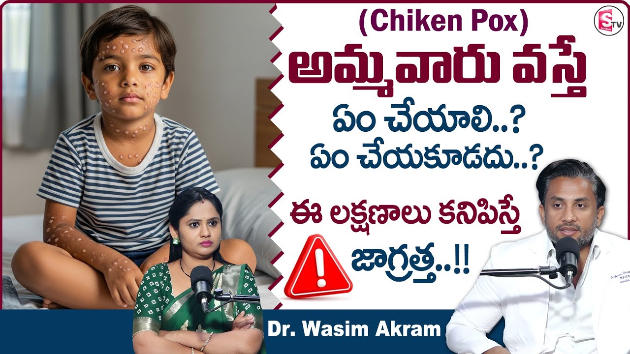 Dr. Wasim Akram : Chicken Pox in Children - Early Signs Parents Must Not Ignore | SumanTV Usha