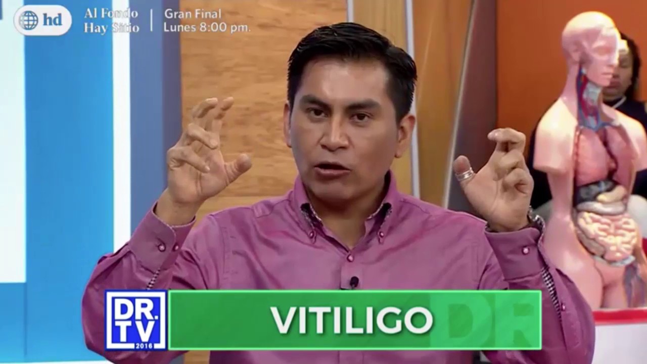 DR.TV – Vitiligo