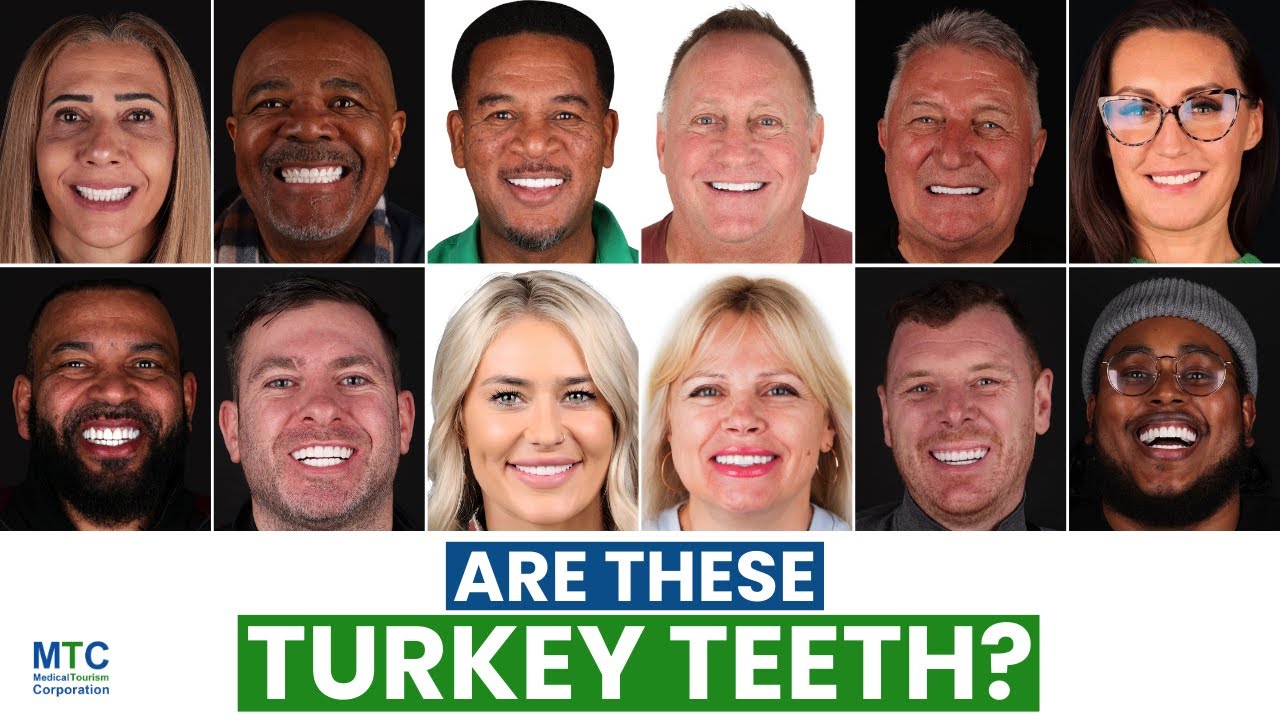 Cosmetic Dentistry in Istanbul: How To Get a Hollywood Smile in Turkey!