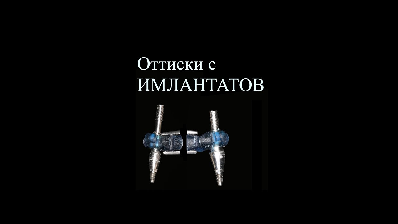 Оттиски (слепки) с имплантатов. Имплантат, формирователь, аналог и т.д. The impression with implant