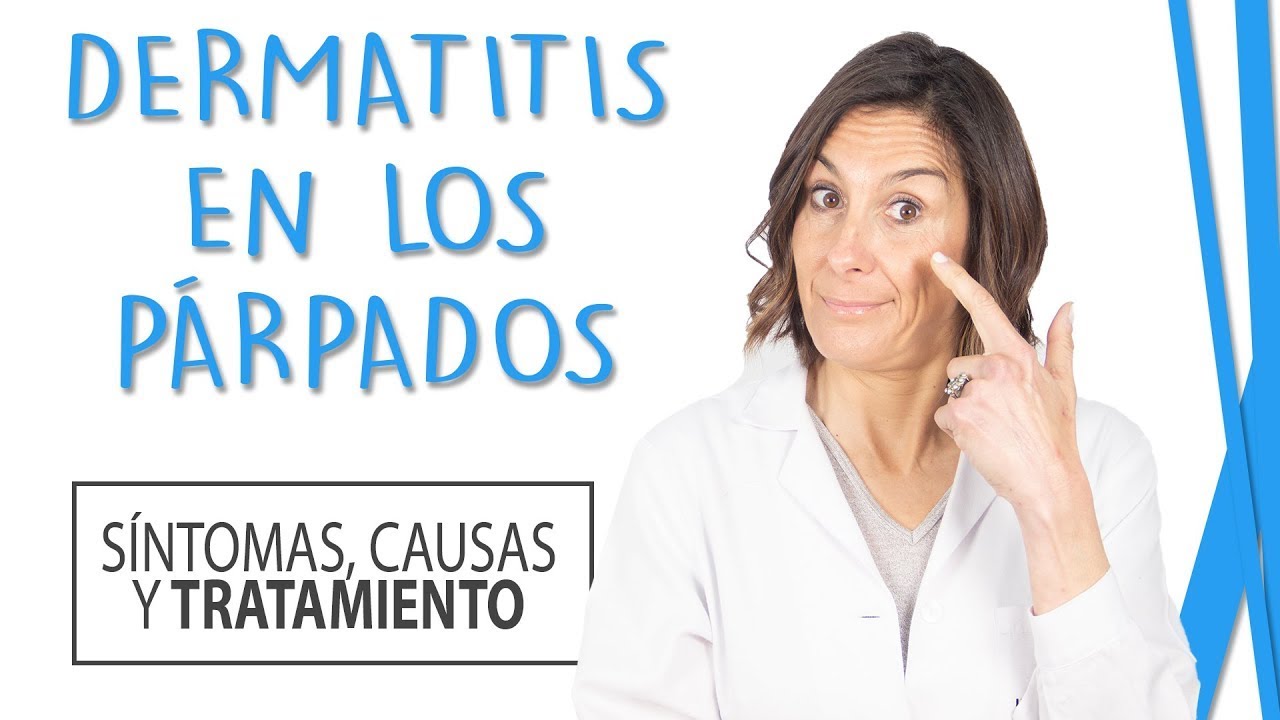 Dermatitis en los Párpados - Síntomas, Causas y Tratamiento