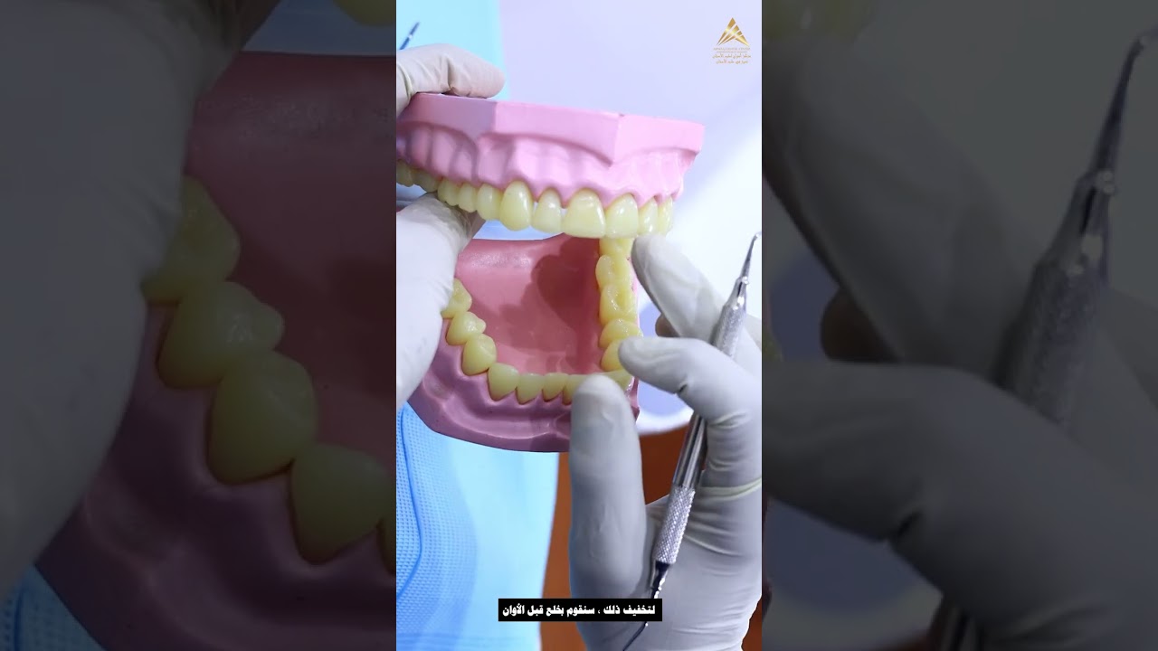 Serial extractions