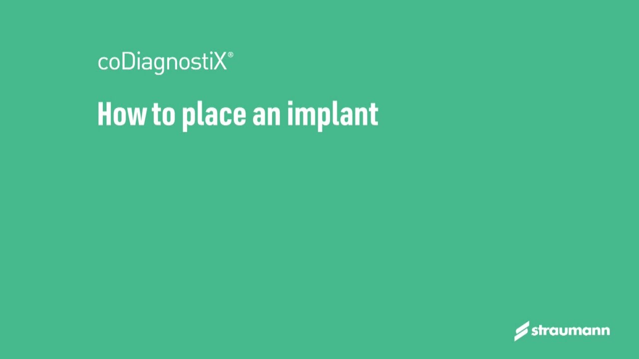 How to place an implant in coDiagnostiX®
