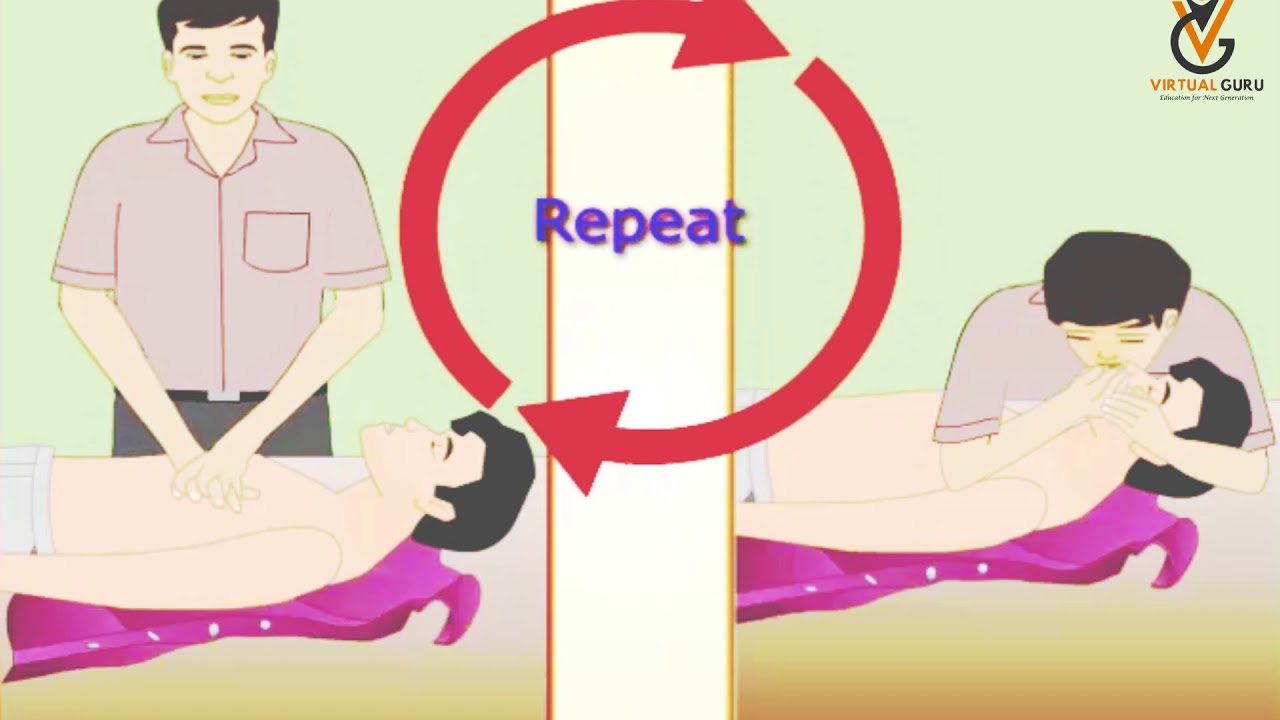 Cardiopulmonary Resuscitation | Virtual Guru