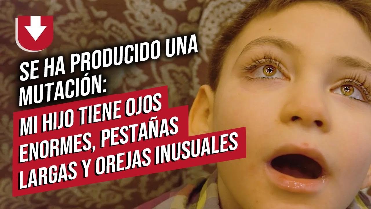 Mi hijo tiene síndrome de Kabuki: Liliana nos cuenta su historia