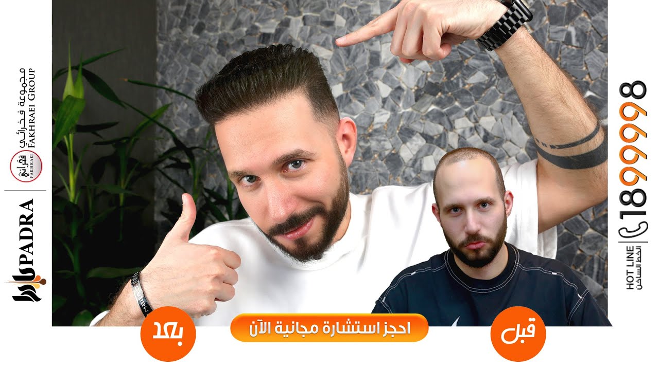 أحدث تقنيات لزراعة الشعر في مركز بادرا، نضمن لك استعادة الشعر بكثافة عالية وشكل طبيعي