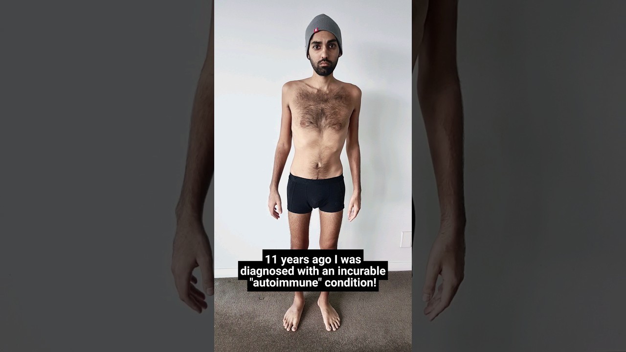 From 35kg to... 😱😱😱 #shorts #shortvideo #ibd #ulcerativecolitis #crohnsdisease #shortsvideo