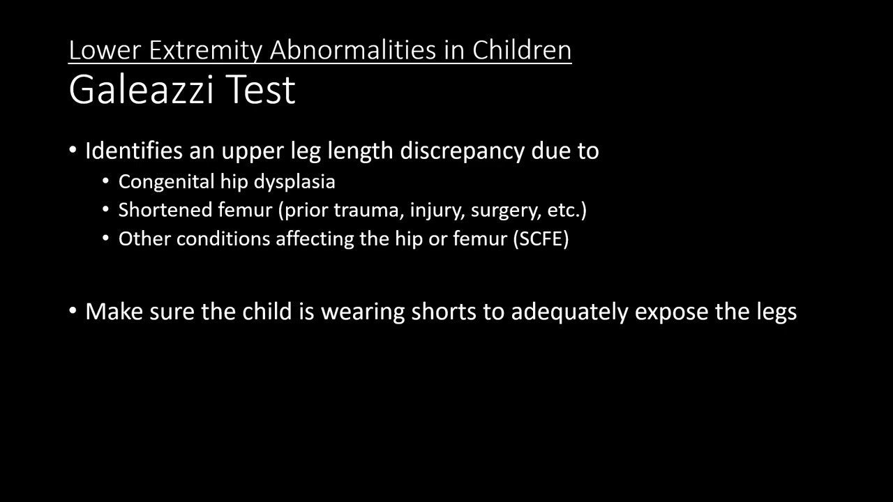 Lower Extremity Abnormalities in Children: Galeazzi Test