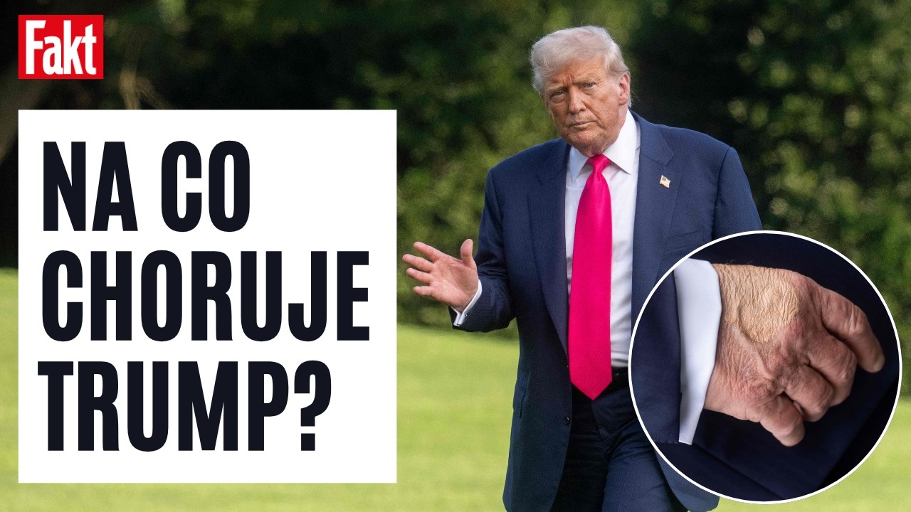NA CO CHORUJE DONALD TRUMP? UJAWIONO PEŁNY RAPORT  | FAKT
