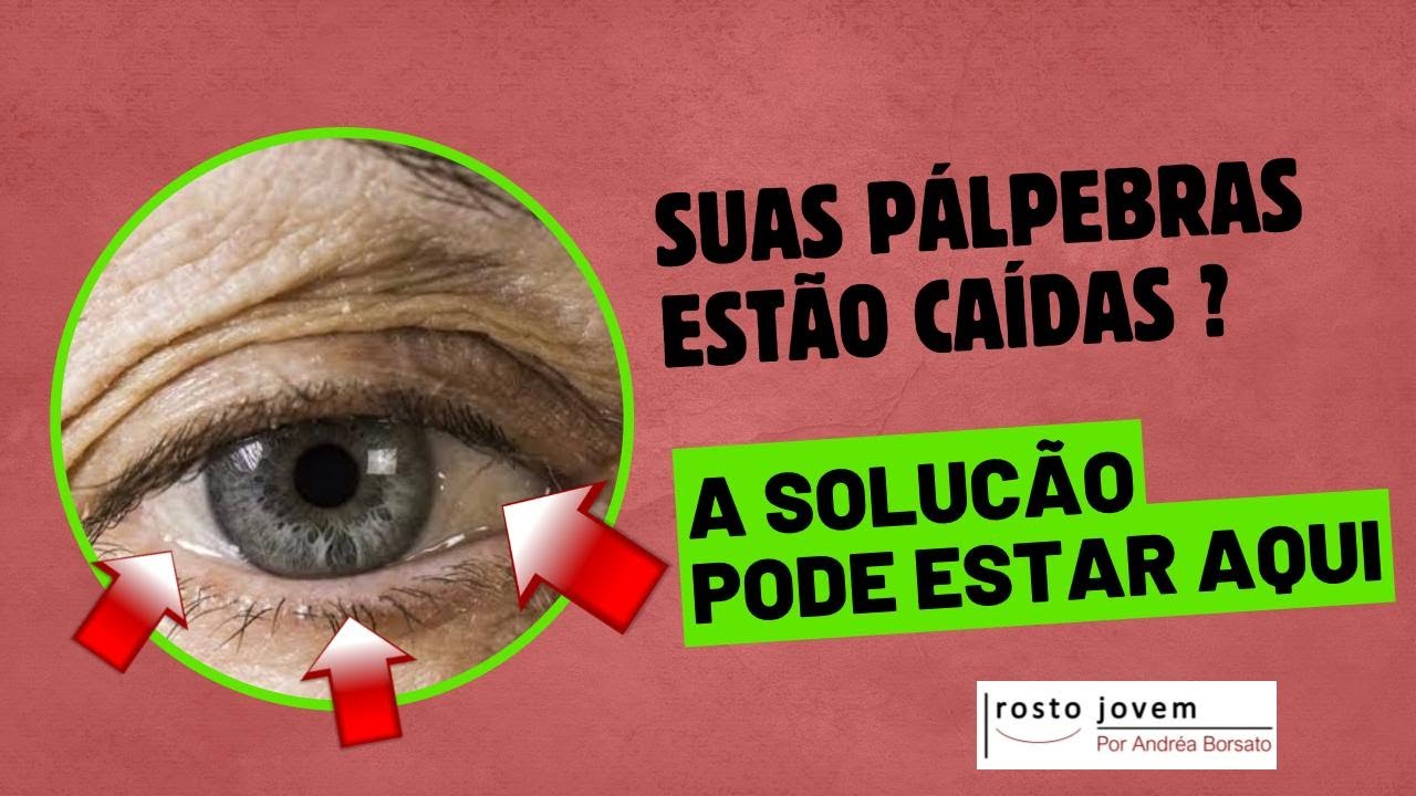 Palpebras caídas