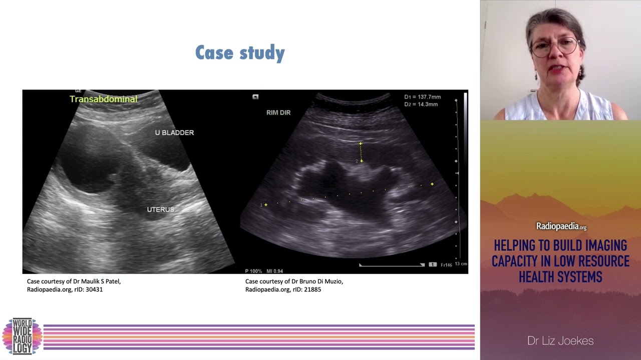 Helping to build imaging capacity in low resource health systems by Dr Liz Joekes