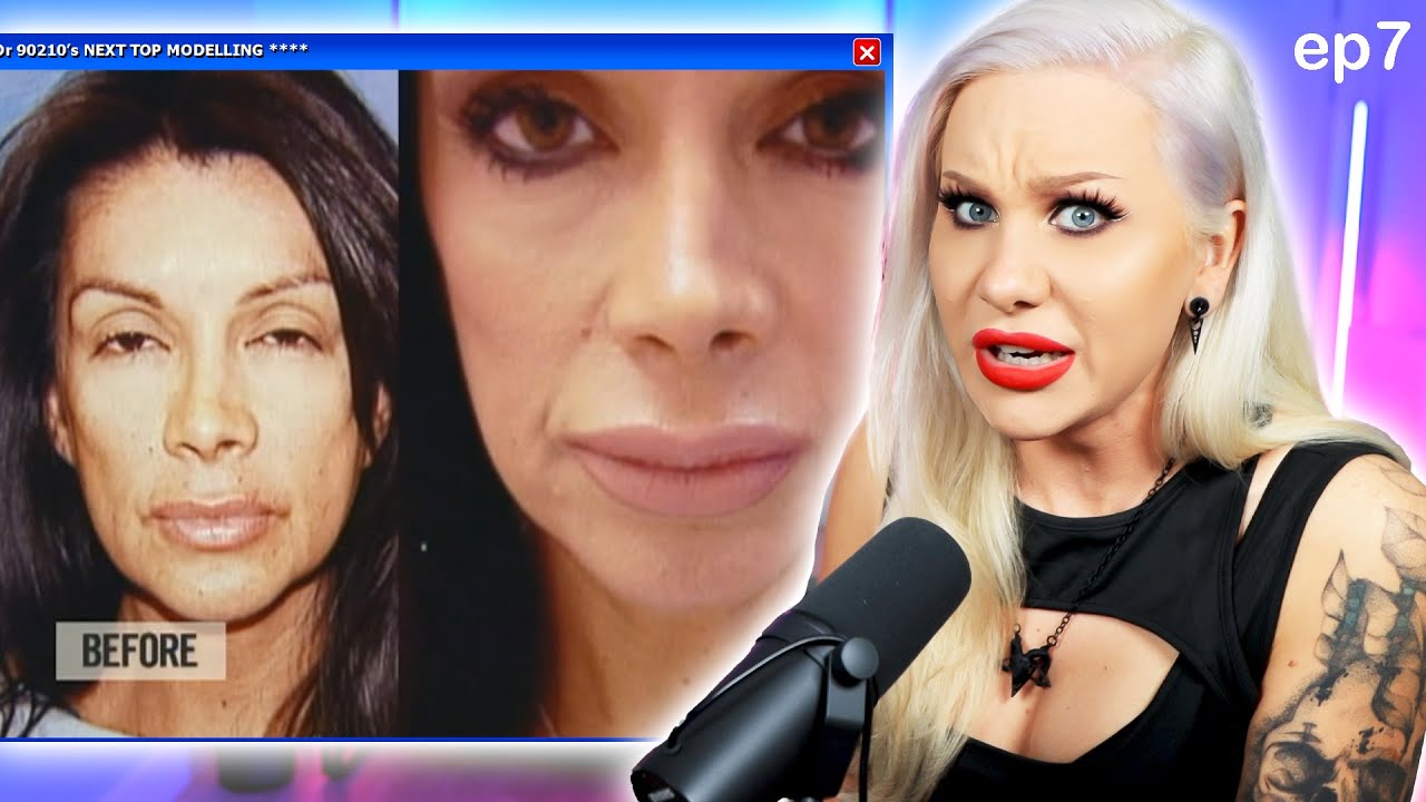 She got a Lip Transplant to fix Botched filler. (Dr. 90210) | Luxeria
