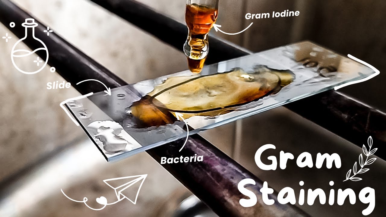 Gram staining procedure 🌸🔬 Bacterial staining technique | How to perform a gram stain |Microbiology