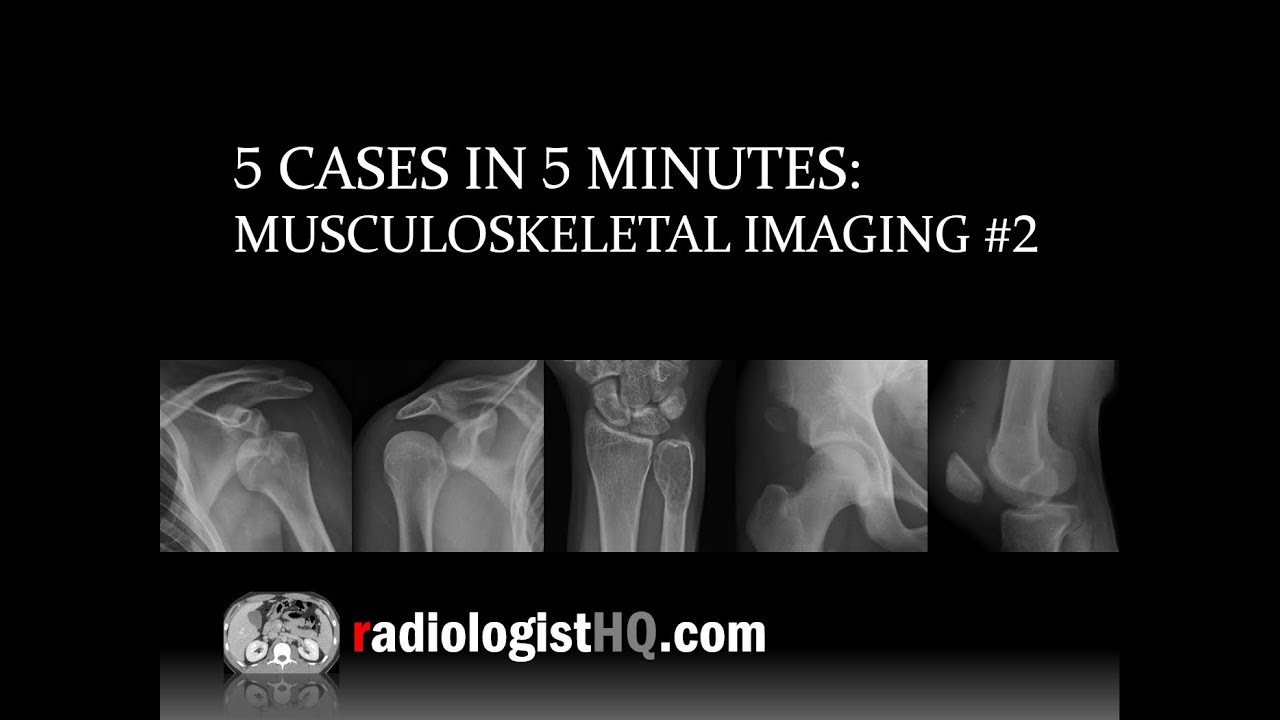 5 Cases in 5 Minutes: Musculoskeletal #2