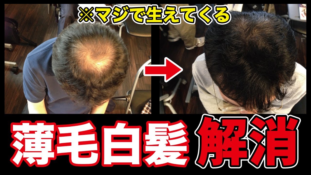 【頭皮リンパ流し】1日1分で白髪や薄毛を解消！自分の手で頭皮を耕すリンパケア