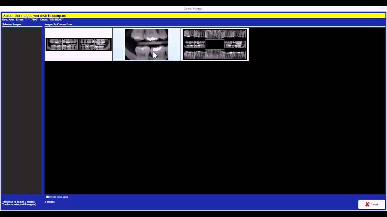 How to Compare X-rays Simultaneously | DentiMax Dental Imaging Software Tip