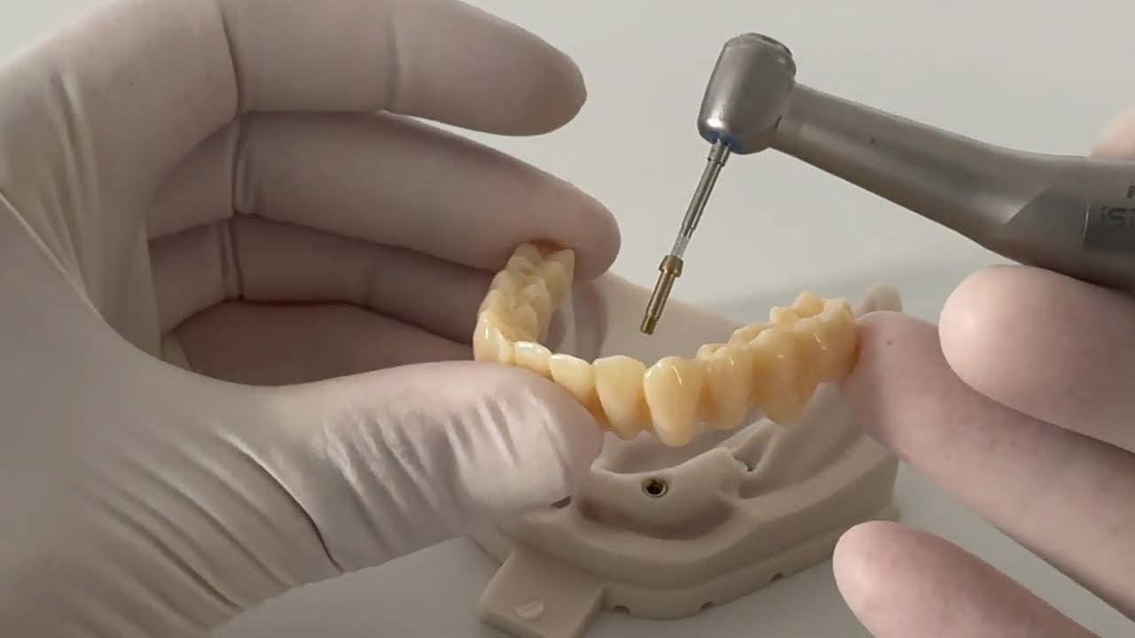 How to Insert All-on-X Provisionals with matrix® Implants | Tutorial