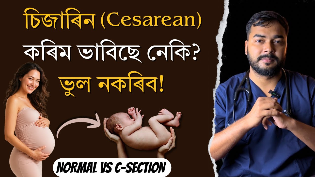 ডেলিভাৰী নৰমেল কৰিবনে চিজাৰিন কৰিব | Normal Vs Cesarean Section Delivery | Dr. Hriday J Deka