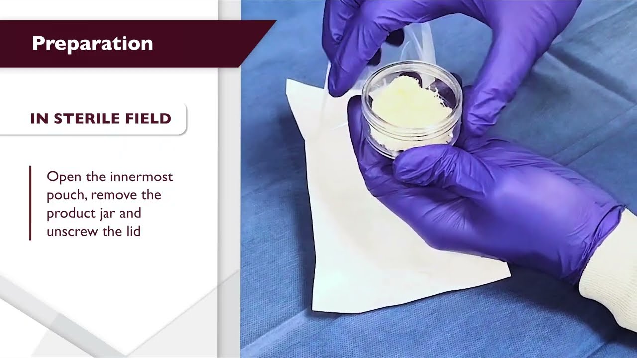 VelvetDBF&trade;: Handling and Preparation | Cervos Medical