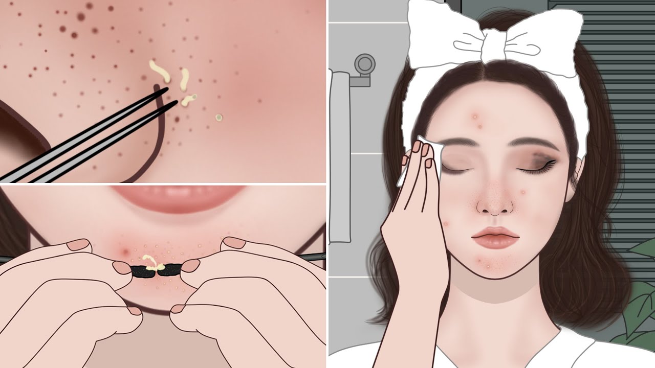 Oddly Satisfying ASMR Animation: Pimple Popping + Blackhead Removal ✨ Night Skincare Routine