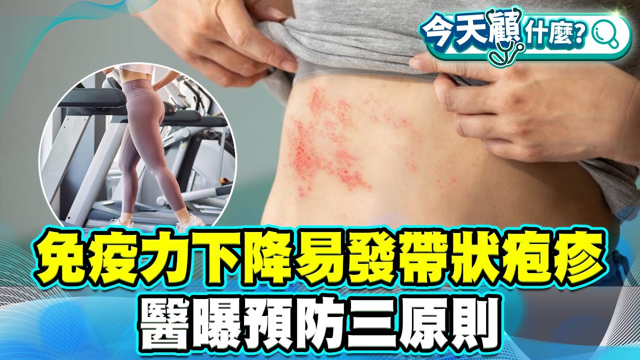 身體免疫力下降 易發生帶狀疱疹！醫曝預防三原則：充足睡眠、經常運動、接種疫苗！【#今天顧什麼？】健康2.0 ​ @tvbshealth20​