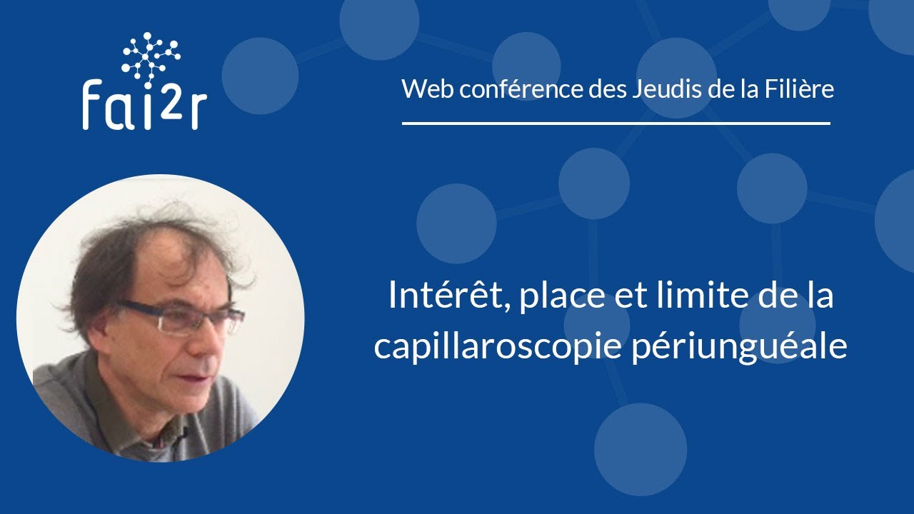 Intérêt, place et limite de la capillaroscopie périunguéale