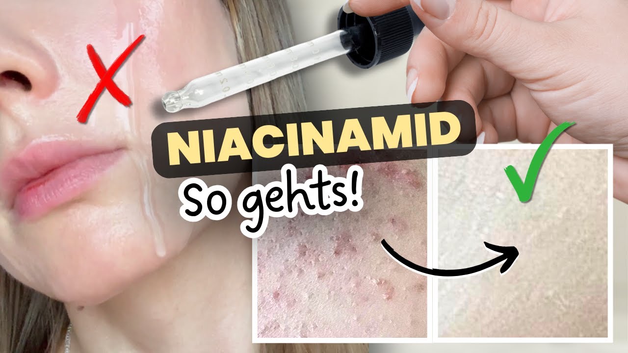 Das Niacinamid Problem + Lösung (98% wissen das nicht)