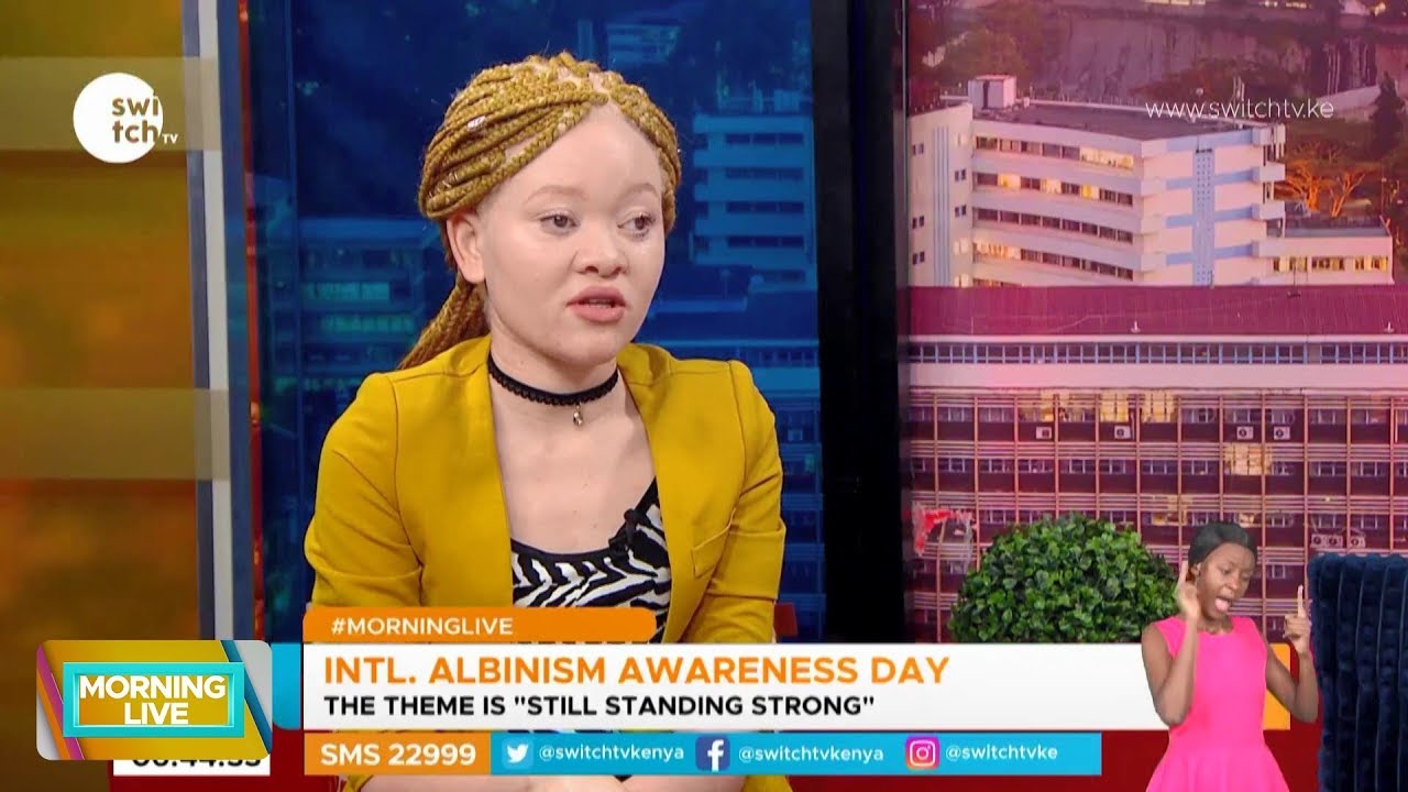 People stared at me during my first days in School - Albinism