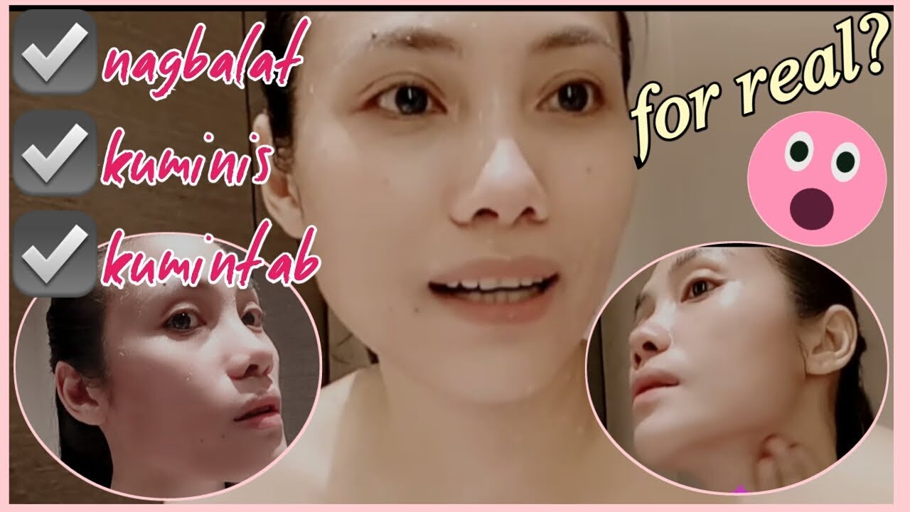 6 MONTHS OF USING MAXI PEEL EXFOLIANT #3 | MAXI PEEL REVIEW (PROVEN TESTED! )| MC ANTOINE