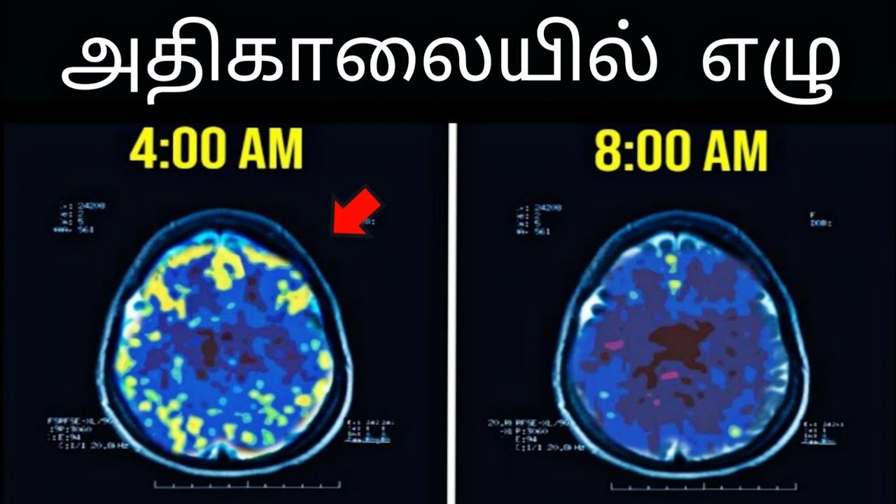 EARLY MORNING எழுவதின்SECRET&BENEFITS  || How to Wakeup Early || Tamil | Time For Greatness Tamil
