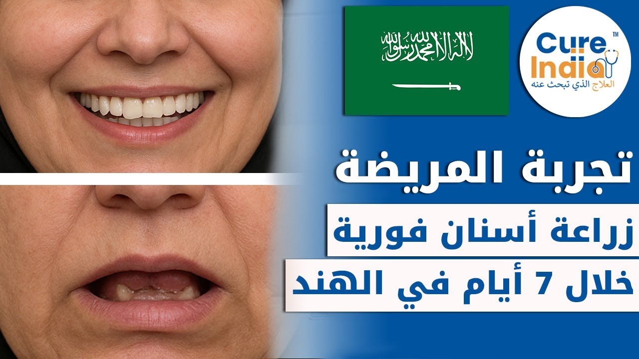 مريضة ضمور العظام جائت من المملكة العربية السعودية لإجراء عملية زراعة الاسنان الفورية في الهند