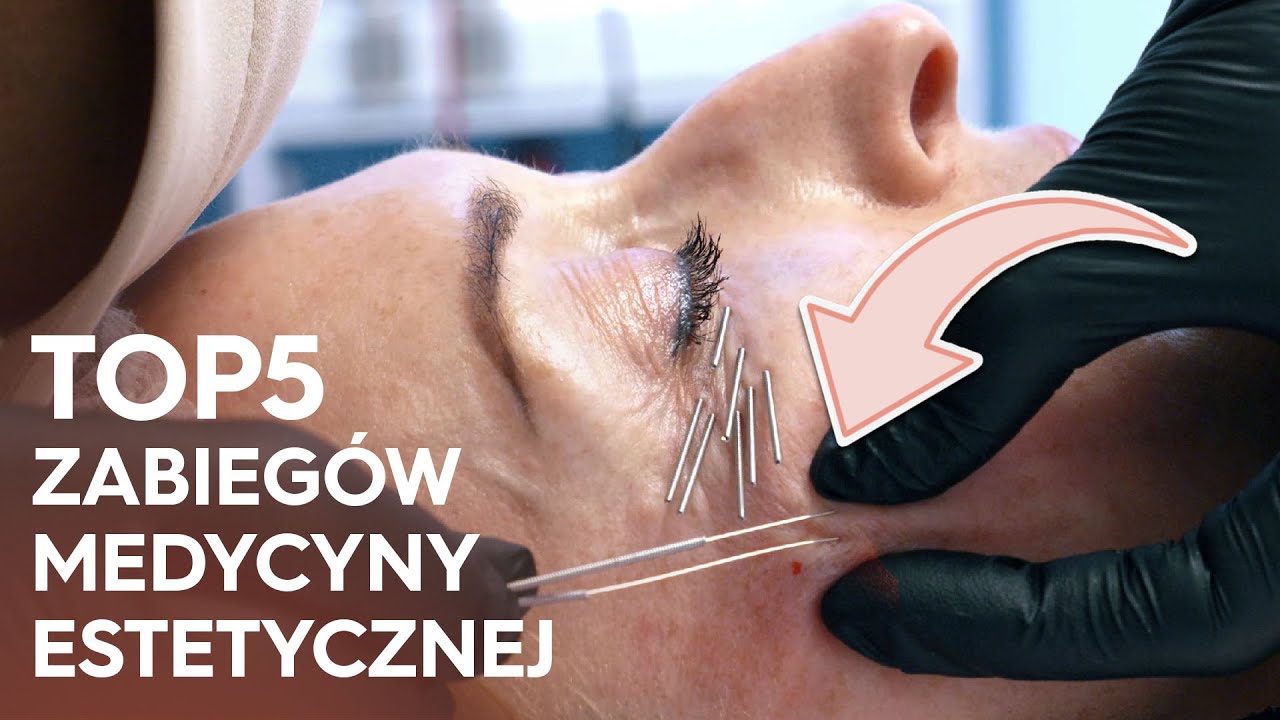 TO NAJLEPSZE ZABIEGI MEDYCYNY ESTETYCZNEJ BEZ SKALPELA