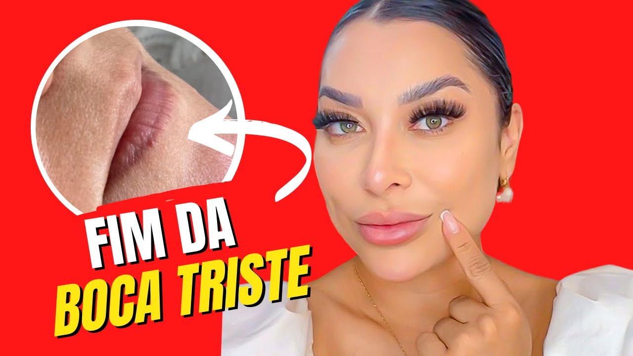Como Levantar o Cantinho da Boca (Tratamentos Estéticos)
