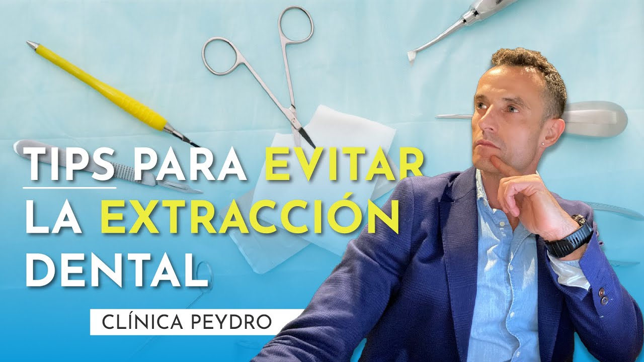 Extracci&oacute;n dental, &iquest;C&oacute;mo evitarlo?