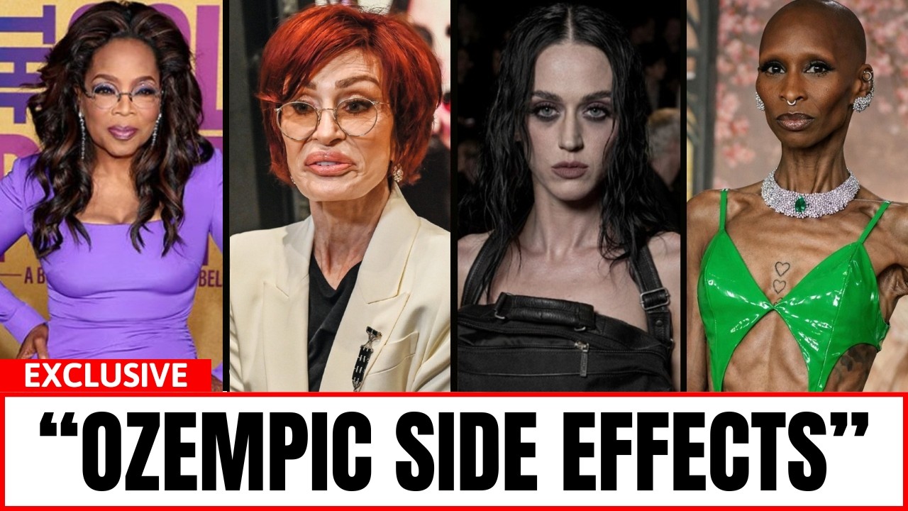 10 Celebrities With Ozempic Face Before & After – #6 Is Unbelievable