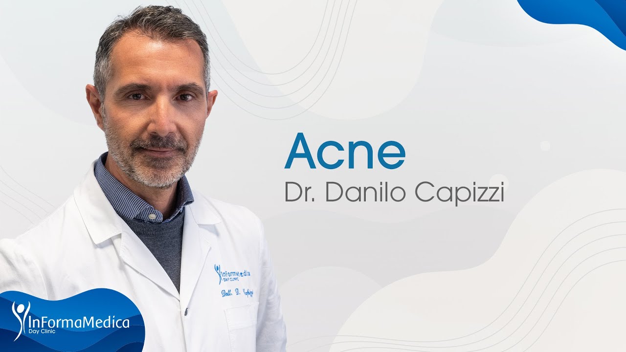 InformaMedica - Acne - Dr. Danilo Capizzi - #acne #dermatologia
