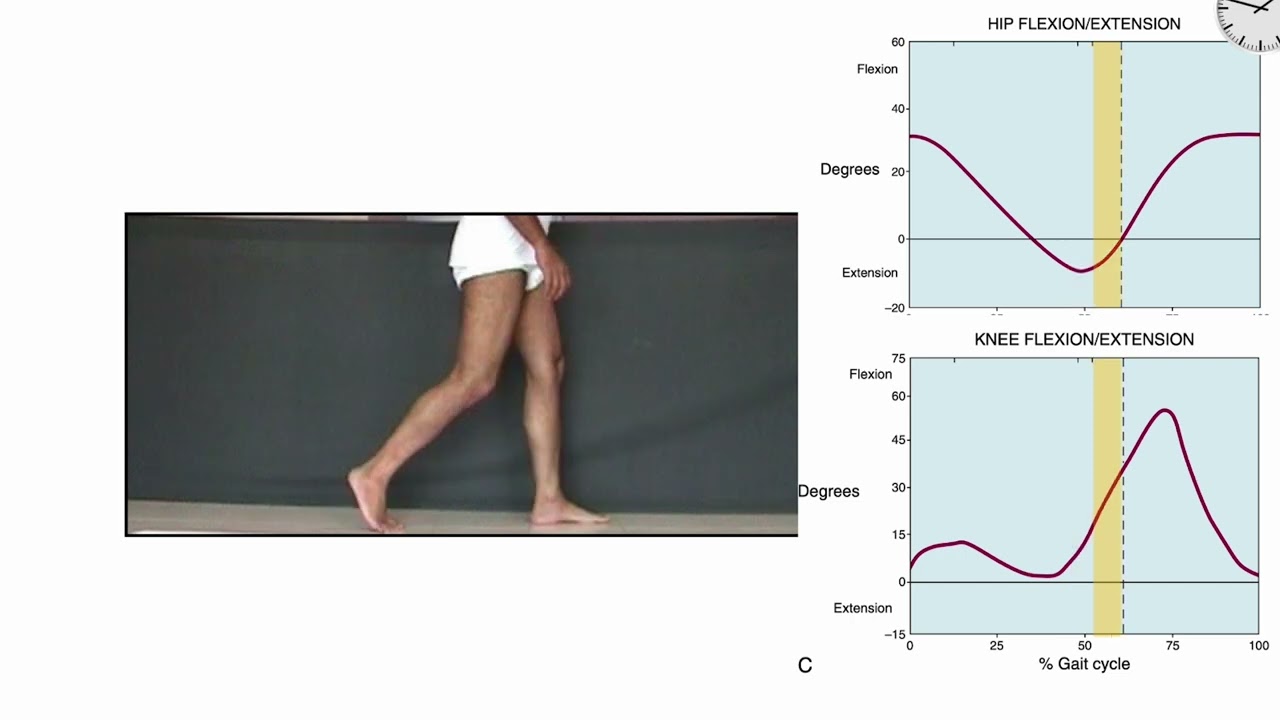 Understanding Gait analysis kinematic charts