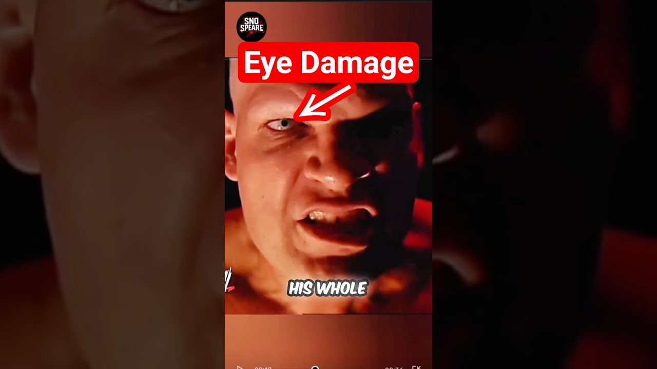 Why was Kane&rsquo;s right eye damaged like this? #wwe #kane