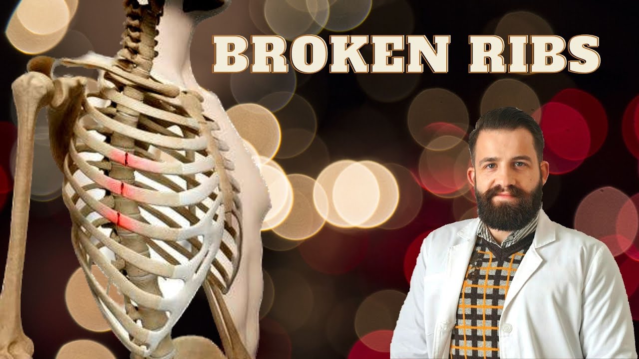 Treating a Broken Rib with Balance Method and Master Tung Acupuncture